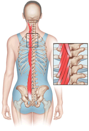 PARASPINAL MUSCLES – Yanni